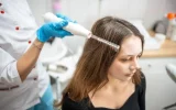 Treatment For Hair Loss In Women