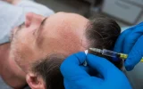 Losing Hair Treatment That Really Works