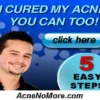 Acne No More Acne No More